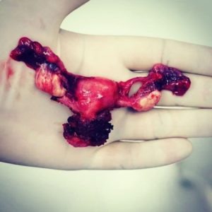 utero-arte no caos